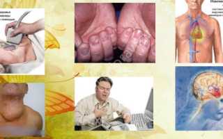 Основные симптомы нехватки йода в организме